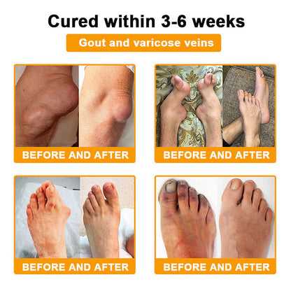 Myo Clinic BEE VENOM LITHOSPERMUM Pain-Relief Bone Healing Cream 👑(Specially for older adults)