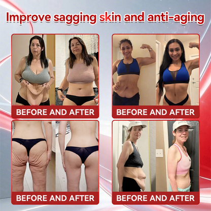 Croaie® 𝑮𝐋𝗣-𝟭 + 𝑪𝒐𝒍𝒍𝙖𝙜𝙚𝙣 𝐏𝐞𝐩𝒕𝒊𝒅𝒆𝒔 𝑾𝒆𝒊𝗴𝗵𝘁 𝐋𝐨𝐬𝐬 & 𝑭𝒊𝒓𝒎𝙞𝙣𝙜 𝑶𝒓𝒂𝐥 𝑺𝒐𝐥𝒖𝒕𝒊𝒐𝒏 💚💚 𝗼𝗯𝗲𝘀𝗶𝘁𝘆, 𝗳𝗶𝗿𝗺𝘀 𝘀𝗸𝗶𝗻, 𝗰𝗮𝗿𝗱𝗶𝗼𝘃𝗮𝘀𝗰𝘂𝗹𝗮𝗿 𝗱𝗶𝘀𝗲𝗮𝘀𝗲, 𝗱𝗶𝗮𝗯𝗲𝘁𝗲𝘀, 𝘀𝗹𝗲𝗲𝗽 𝗮𝗽𝗻𝗲𝗮, 𝗷𝗼𝗶𝗻𝘁 𝗽𝗿𝗼𝗯𝗹𝗲𝗺𝘀, 𝗮𝗻𝗱 𝗺𝗼𝗿𝗲