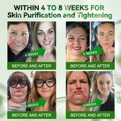 𝗥𝗮𝗶𝗻𝗗𝗲𝘄® 𝗚𝗟𝗣-𝟭 𝗠𝗲𝘁𝗮𝗯𝗼𝗹𝗶𝗰 𝗘𝘅𝘁𝗿𝗮 𝗦𝘁𝗿𝗲𝗻𝗴𝘁𝗵 𝗦𝗹𝗶𝗺𝗺𝗶𝗻𝗴 𝗦𝘂𝗽𝗽𝗼𝗿𝘁 𝗢𝗿𝗮𝗹 𝗦𝗼𝗹𝘂𝘁𝗶𝗼𝗻 for Digestive Cleanse ,𝑶𝒃𝒆𝒔𝒊𝒕𝒚, 𝑴𝒆𝒏𝒕𝒂𝒍 𝑪𝒍𝒂𝒓𝒊𝒕𝒚,𝑫𝒊𝒂𝒃𝒆𝒕𝒆𝒔, 𝑫𝒊𝒈𝒆𝒔𝒕𝒊𝒗𝒆 & 𝑪𝒂𝒓𝒅𝒊𝒐𝒗𝒂𝒔𝒄𝒖𝒍𝒂𝒓 𝑯𝒆𝒂𝒍𝒕𝒉, 𝑱𝒐𝒊𝒏𝒕 𝑺𝒖𝒑𝒑𝒐𝒓𝒕, 𝑺𝒌𝒊𝒏 𝑭𝒊𝒓𝒎𝒊𝒏𝒈, 𝑨𝒏𝒕𝒊-𝑨𝒈𝒊𝒏𝒈, 𝑺𝒕𝒓𝒆𝒔𝒔 𝑹𝒆𝒍𝒊𝒆𝒇 & 𝑬𝒏𝒆𝒓𝒈𝒚