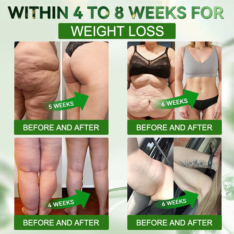 𝗥𝗮𝗶𝗻𝗗𝗲𝘄® 𝗚𝗟𝗣-𝟭 𝗠𝗲𝘁𝗮𝗯𝗼𝗹𝗶𝗰 𝗘𝘅𝘁𝗿𝗮 𝗦𝘁𝗿𝗲𝗻𝗴𝘁𝗵 𝗦𝗹𝗶𝗺𝗺𝗶𝗻𝗴 𝗦𝘂𝗽𝗽𝗼𝗿𝘁 𝗢𝗿𝗮𝗹 𝗦𝗼𝗹𝘂𝘁𝗶𝗼𝗻 for Digestive Cleanse ,𝑶𝒃𝒆𝒔𝒊𝒕𝒚, 𝑴𝒆𝒏𝒕𝒂𝒍 𝑪𝒍𝒂𝒓𝒊𝒕𝒚,𝑫𝒊𝒂𝒃𝒆𝒕𝒆𝒔, 𝑫𝒊𝒈𝒆𝒔𝒕𝒊𝒗𝒆 & 𝑪𝒂𝒓𝒅𝒊𝒐𝒗𝒂𝒔𝒄𝒖𝒍𝒂𝒓 𝑯𝒆𝒂𝒍𝒕𝒉, 𝑱𝒐𝒊𝒏𝒕 𝑺𝒖𝒑𝒑𝒐𝒓𝒕, 𝑺𝒌𝒊𝒏 𝑭𝒊𝒓𝒎𝒊𝒏𝒈, 𝑨𝒏𝒕𝒊-𝑨𝒈𝒊𝒏𝒈, 𝑺𝒕𝒓𝒆𝒔𝒔 𝑹𝒆𝒍𝒊𝒆𝒇 & 𝑬𝒏𝒆𝒓𝒈𝒚