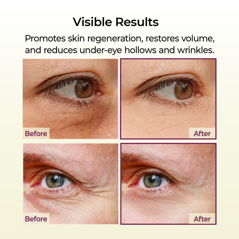 🌷[Dr.Meloxin Official] 80%OFF✨Cemenrete Calcium Multi Balm | Anti-aging, Sagging, Wrinkles