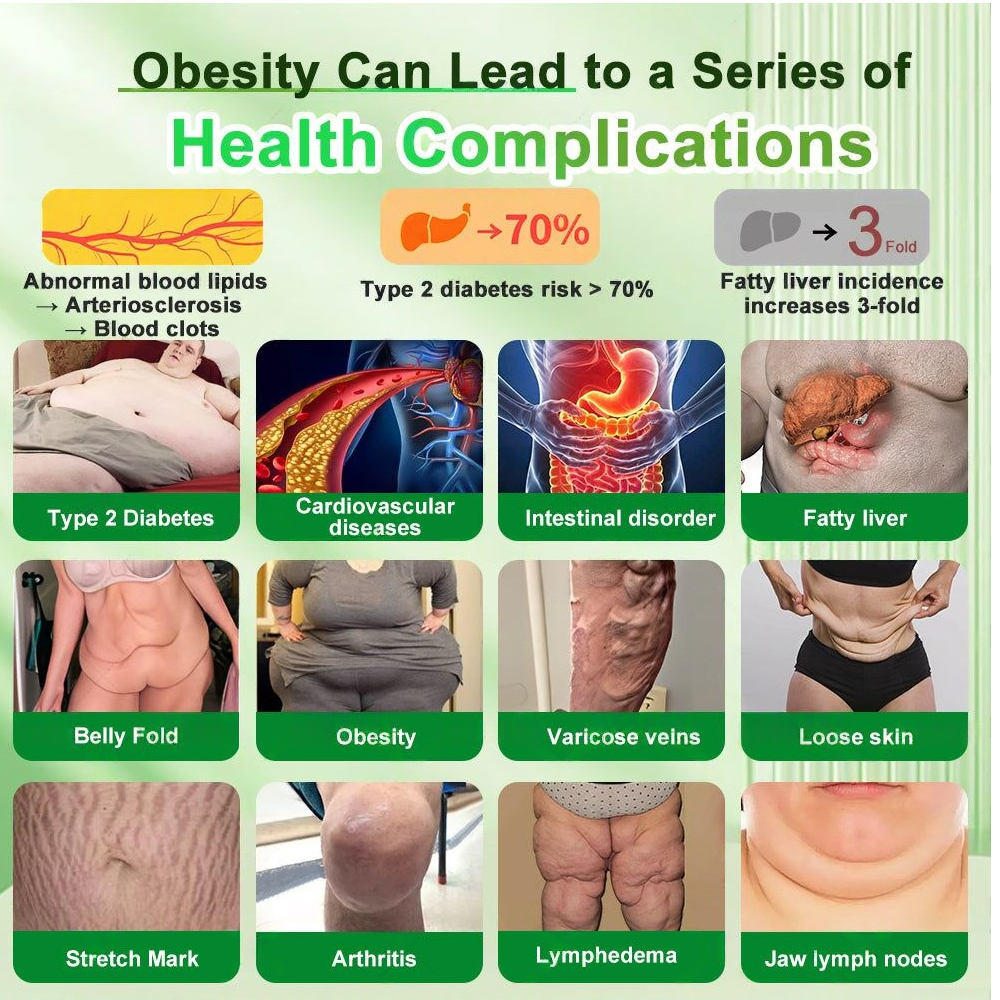 🔥New Arrival🇺🇸CVS Online | Croaie® 𝗚𝗟𝗣-𝟭 𝟐𝟎-𝐢𝐧-𝟏 𝐒𝐥𝐢𝐦 & 𝐇𝐞𝐚𝐥𝐭𝐡 𝐎𝐫𝐚𝐥 𝐒𝐨𝐥𝐮𝐭𝐢𝐨𝐧 -𝑶𝒏𝒄𝒆 𝒂 𝒅𝒂𝒚, 𝒓𝒆𝒔𝒖𝒍𝒕𝒔 𝒊𝒏 6 𝒅𝒂𝒚𝒔, 𝑾𝒊𝒕𝒉 100 𝑩𝒊𝒍𝒍𝒊𝒐𝒏 𝑪𝑭𝑼 𝑨𝒄𝒕𝒊𝒗𝒆 𝑷𝒓𝒐𝒃𝒊𝒐𝒕𝒊𝒄𝒔 ✅ 𝑺𝒖𝒑𝒑𝒐𝒓𝒕𝒔 𝒘𝒆𝒊𝒈𝒉𝒕 𝒎𝒂𝒏𝒂𝒈𝒆𝒎𝒆𝒏𝒕, 𝒉𝒆𝒂𝒓𝒕 𝒉𝒆𝒂𝒍𝒕𝒉, 𝒅𝒊𝒂𝒃𝒆𝒕𝒆𝒔, 𝒈𝒖𝒕 & 𝒘𝒐𝒎𝒆𝒏’𝒔 𝒉𝒆𝒂𝒍𝒕𝒉, 𝒘𝒉𝒊𝒍𝒆 𝒇𝒊𝒓𝒎𝒊𝒏𝒈 𝒔𝒌𝒊𝒏