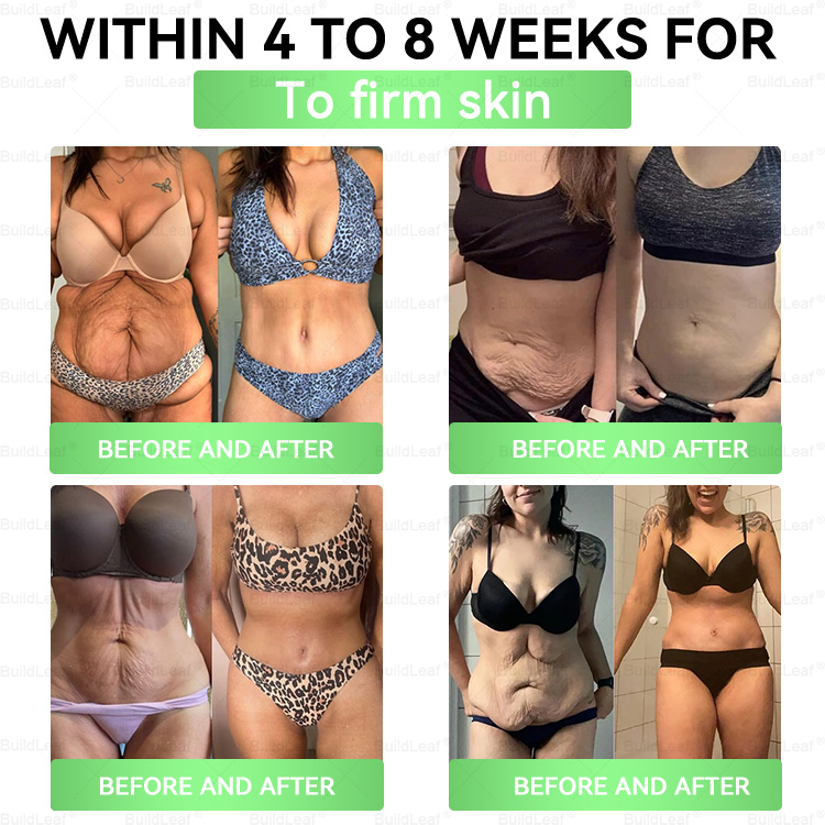 🔥CVS Online | 𝘽𝙪𝙞𝙡𝙙𝙇𝙚𝙖𝙛® 𝗚𝗟𝗣-𝟭 𝟖-𝗶𝗻-𝟭 𝗦𝗹𝗶𝗺 & 𝑯𝒆𝒂𝒍𝒕𝒉𝐲 𝑶𝒓𝒂𝒍 𝑺𝒐𝒍𝒖𝒕𝒊𝒐𝒏 𝑂𝑛𝑐𝑒 𝑎 𝑑𝑎𝑦, 𝑣𝑖𝑠𝑖𝑏𝑙𝑒 𝑟𝑒𝑠𝑢𝑙𝑡𝑠 𝑖𝑛 7 𝑑𝑎𝑦𝑠)  ✅ 𝗦𝘂𝗽𝗽𝗼𝗿𝘁𝘀 𝗼𝗯𝗲𝘀𝗶𝘁𝘆, 𝗰𝗮𝗿𝗱𝗶𝗼𝘃𝗮𝘀𝗰𝘂𝗹𝗮𝗿 𝗵𝗲𝗮𝗹𝘁𝗵, 𝗱𝗶𝗮𝗯𝗲𝘁𝗲𝘀, 𝘀𝗹𝗲𝗲𝗽 𝗮𝗽𝗻𝗲𝗮, 𝗴𝘂𝘁 𝗵𝗲𝗮𝗹𝘁𝗵, 𝗷𝗼𝗶𝗻𝘁 𝗶𝘀𝘀𝘂𝗲𝘀, 𝐰𝐡𝐢𝐥𝐞 𝐚𝐥𝐬𝐨 𝐟𝐢𝐫𝐦𝐢𝐧𝐠 𝐭𝐡𝐞 𝐬𝐤𝐢𝐧 𝐚𝐧𝐝 𝐛𝐨𝐨𝐬𝐭𝐢𝐧𝐠 𝐞𝐧𝐞𝐫𝐠𝐲.