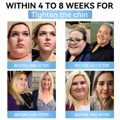 Official Store | Myo Clinic® Longevity GLP-1 8-in-1 Slim & Healthy Oral Solution(Once a day, visible results in 7 days) Supports obesity, cardiovascular health, diabetes, sleep apnea, gut health, joint issues, while also firming the skin