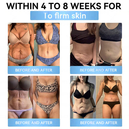 Official Store | Myo Clinic® Longevity GLP-1 8-in-1 Slim & Healthy Oral Solution(Once a day, visible results in 7 days) Supports obesity, cardiovascular health, diabetes, sleep apnea, gut health, joint issues, while also firming the skin