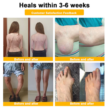 LOTMAY Joint Freedom Formula Cream – 9-in-1 Natural Formula (FDA-Certified & Recommended) Free Shipping